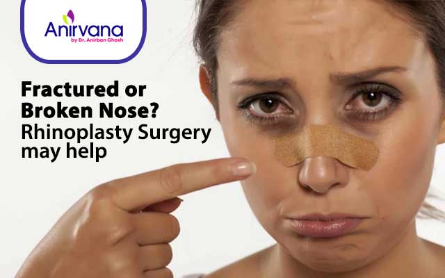 Fractured or broken nose?  Rhinoplasty surgery may help