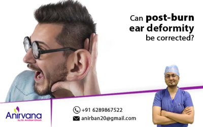 Can post-burn ear deformity be corrected?