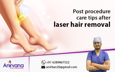 Post procedure care tips after laser hair removal