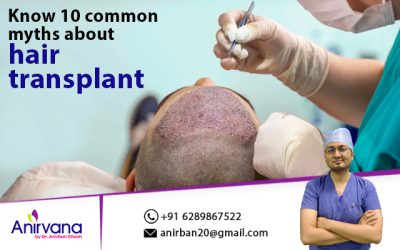 Know 10 common myths about hair transplant