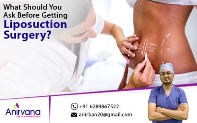 What Should You Ask Before Getting Liposuction Surgery?