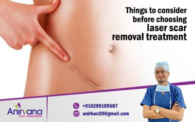 Things to consider before choosing laser scar removal treatment