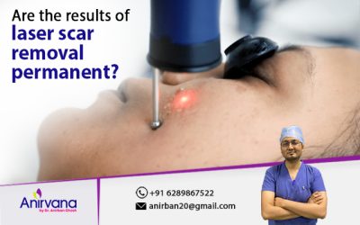 Are the results of laser scar removal permanent?