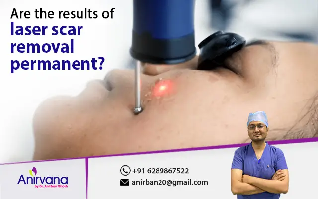 Are the results of laser scar removal permanent?