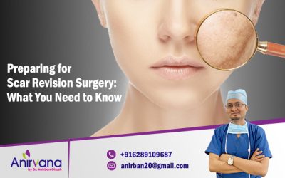 Preparing for Scar Revision Surgery: What You Need to Know