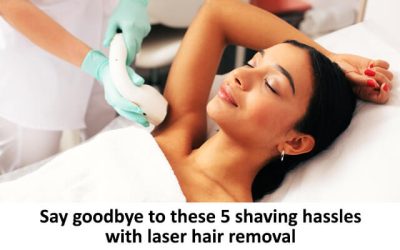 Say goodbye to these 5 shaving hassles with laser hair removal