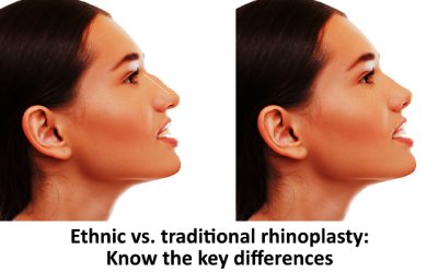 Ethnic vs. traditional rhinoplasty: Know the key differences