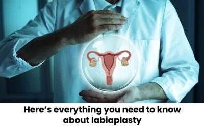Here’s everything you need to know about labiaplasty