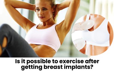 Is it possible to exercise after getting breast implants?
