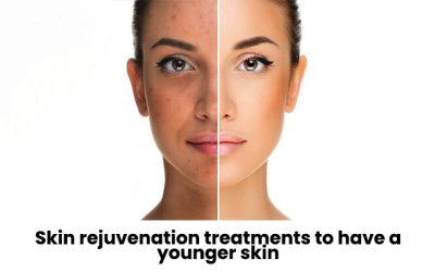 Skin rejuvenation treatments to have a younger skin