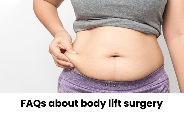 FAQs about body lift surgery