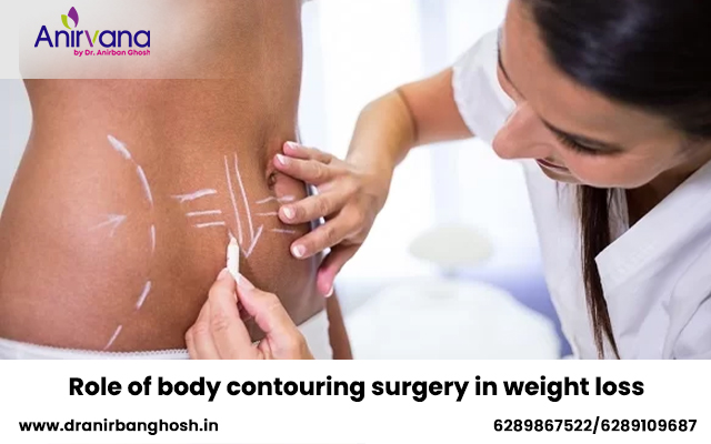 Role of body contouring surgery in weight loss