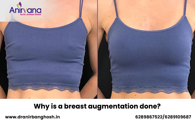 Why is a breast augmentation done?