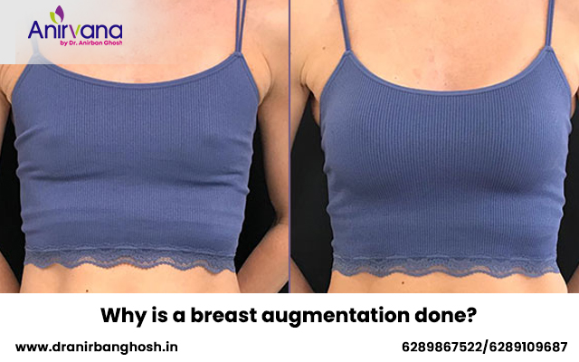 Why is a breast augmentation done?