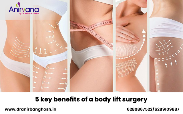 5 key benefits of a body lift surgery