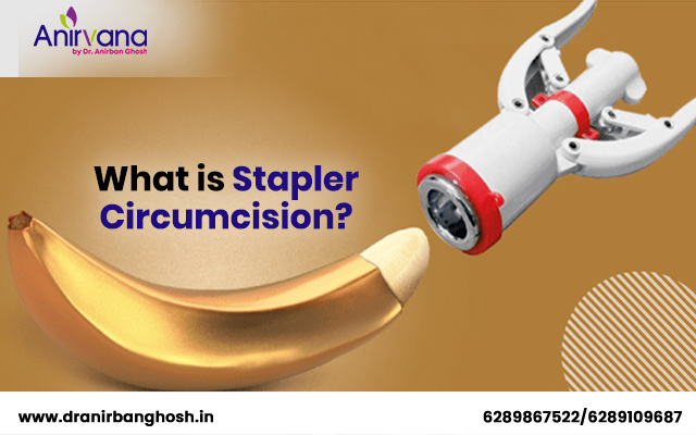 stapler circumcision surgery in Kolkata