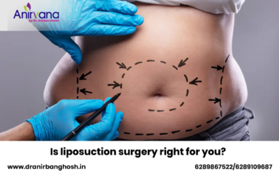 Is liposuction surgery right for you?