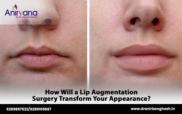 How Will a Lip Augmentation Surgery Transform Your Appearance?