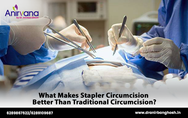 What Makes Stapler Circumcision Better Than Traditional Circumcision?