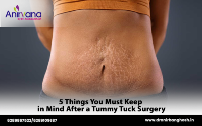 5 Things You Must Keep in Mind After a Tummy Tuck Surgery