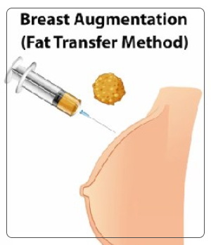 Breast Augmentation