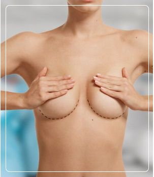 Breast Lift