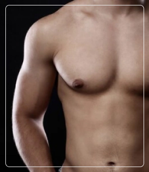 Gynecomastia