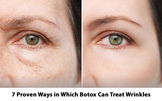 7 Proven Ways in Which Botox Can Treat Wrinkles