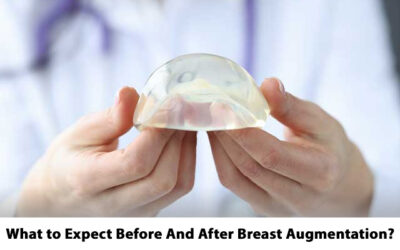 What to Expect Before And After Breast Augmentation?