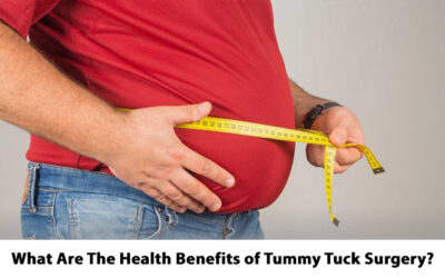 What Are The Health Benefits of Tummy Tuck Surgery