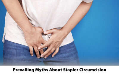 Prevailing Myths About Stapler Circumcision