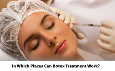 In Which Places Can Botox Treatment Work?