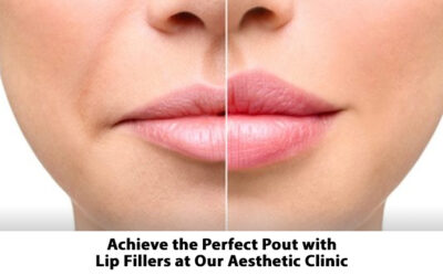 Achieve the Perfect Pout with Lip Fillers at Our Aesthetic Clinic