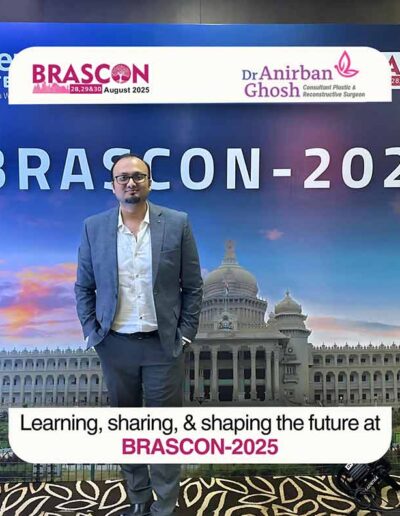 Dr. Anirban Ghosh made a powerful impact at BRASCON-2025, sharing his valuable insights on "Negative Pressure Therapy in Mastopexy.