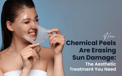 How Chemical Peels Are Erasing Sun Damage: The Aesthetic Treatment You Need