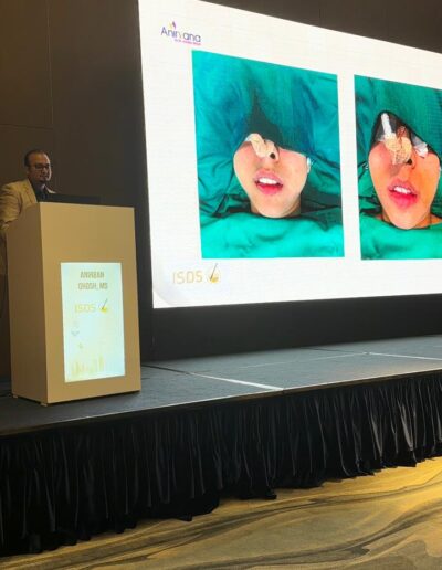 Face Slimming at ISDS