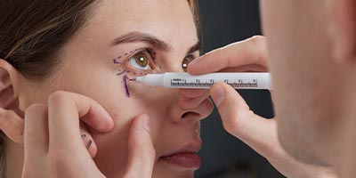 Under-Eye Filler  | Dr. Anirban Ghosh