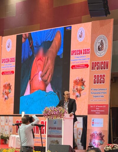 national event of Plastic surgeons at Varanasi