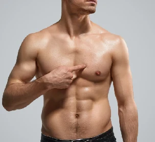 Gynecomastia