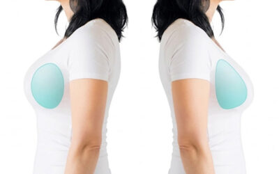 Round vs Teardrop Implants: Which One Is Suitable for Breast Enlargement?