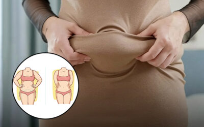 5 Easy Tips to Maintain Liposuction Results Long-Term