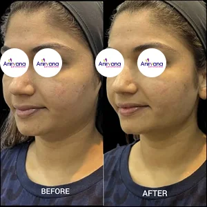 Dr. Anirban Ghosh Before After