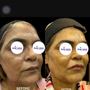 Dr. Anirban Ghosh Before After