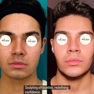 Dr. Anirban Ghosh Before After