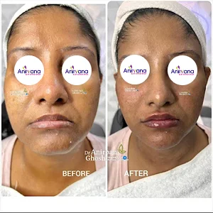 Dr. Anirban Ghosh Before After