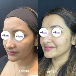 Dr. Anirban Ghosh Before After