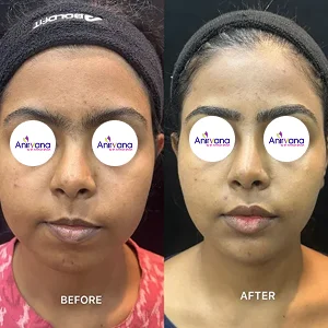 Dr. Anirban Ghosh Before After
