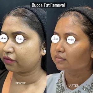 Dr. Anirban Ghosh Before After