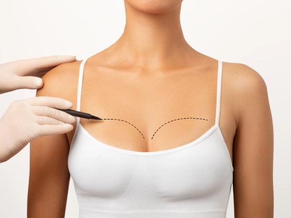 Breast reconstruction surgery in Kolkata